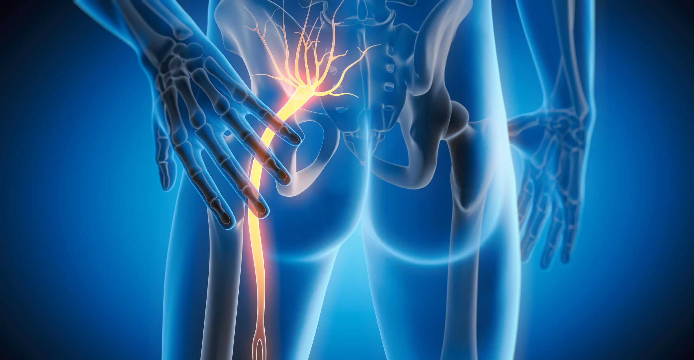 Lumbar  Radiculopathy